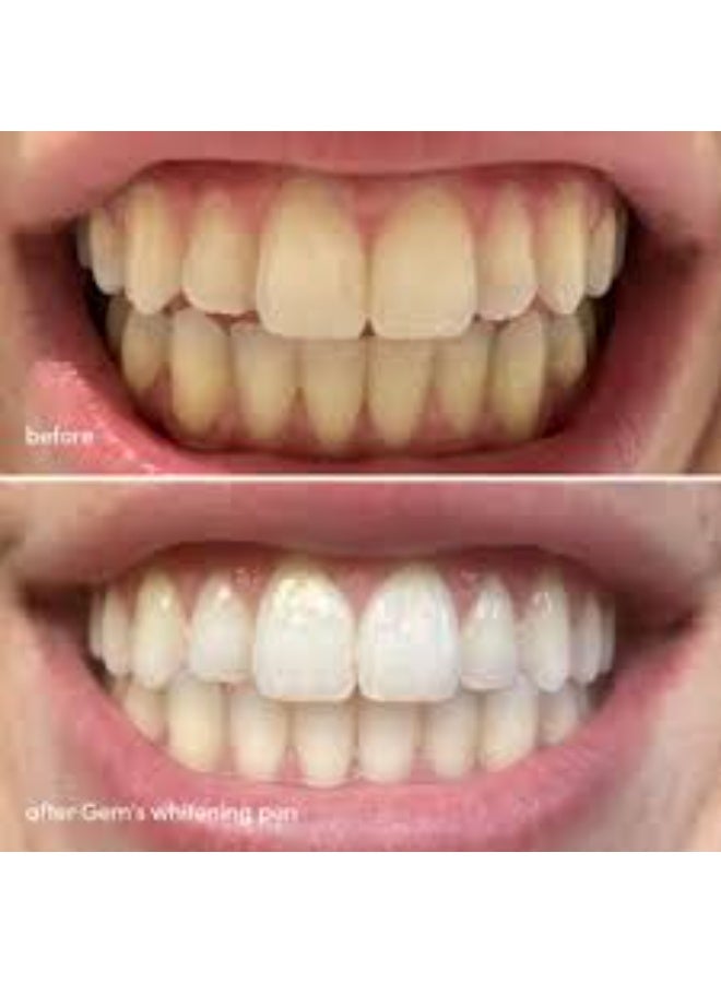 Gem Whitening PAP Pen Coconut Mint 4ml - Image 1